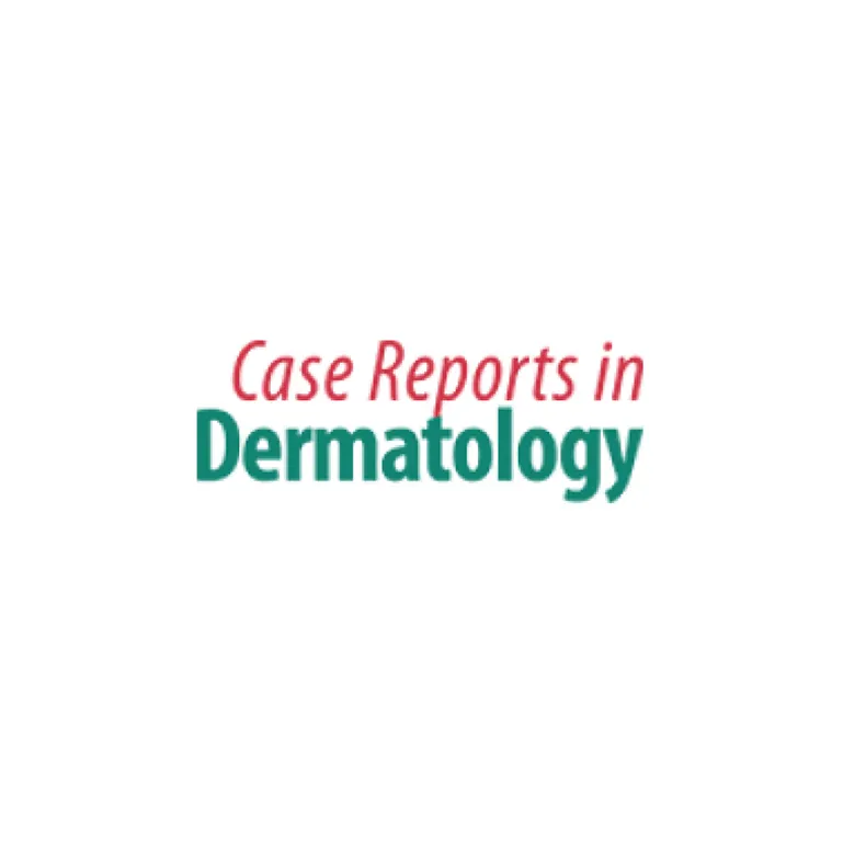 Successful Treatment of Hard Corns in Two Patients Using Microwave Energy